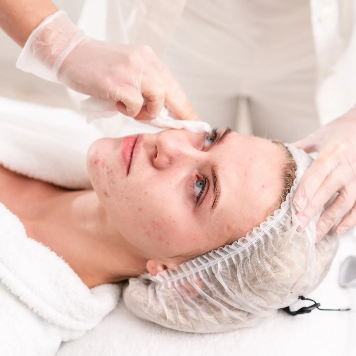 Dermaplaning being performed at Charis Aesthetics