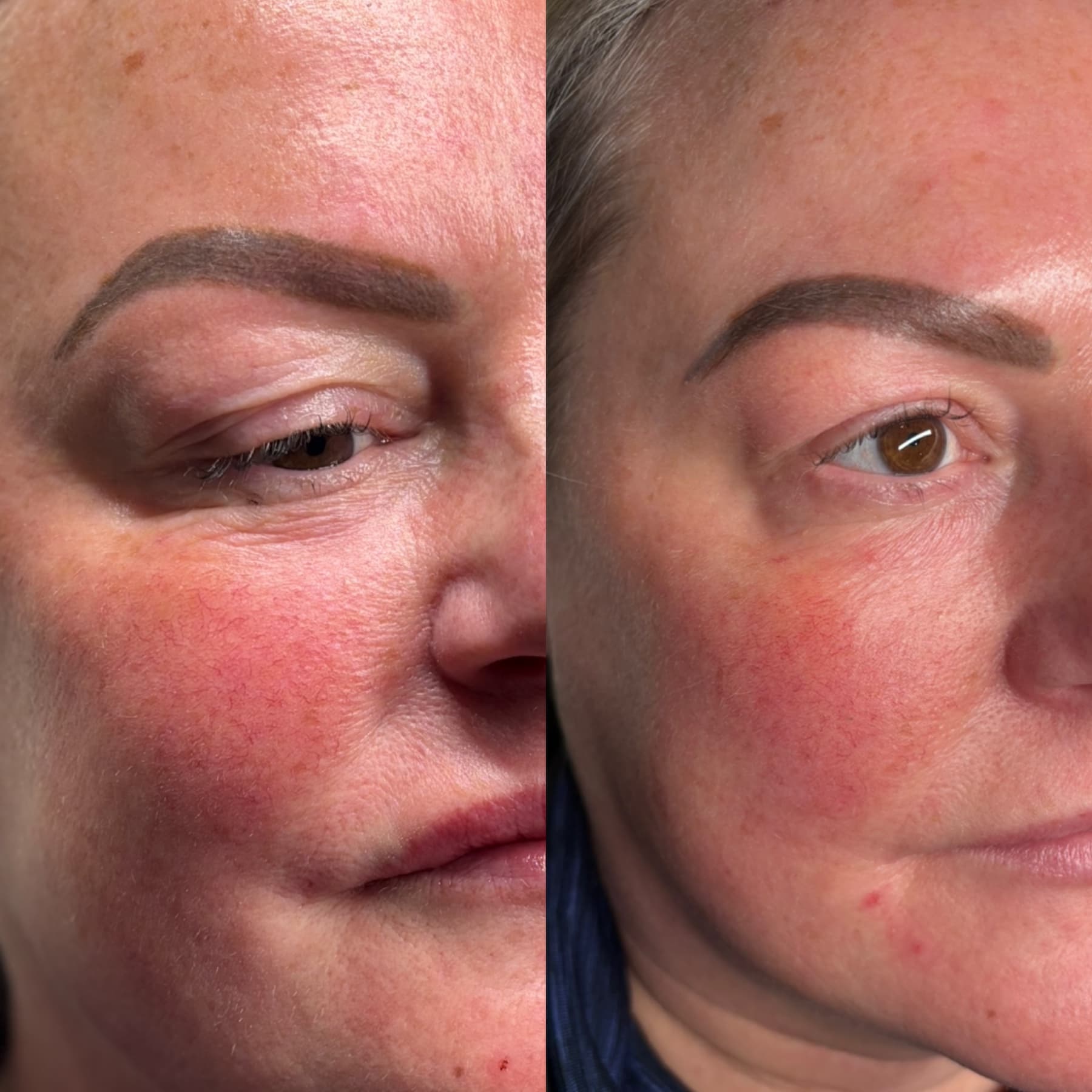 Polynucleotides before and after at Charis Aesthetics